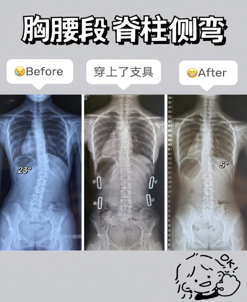 广告人干货库 超全|小红书薯条审核规则指南-广告人干货库
