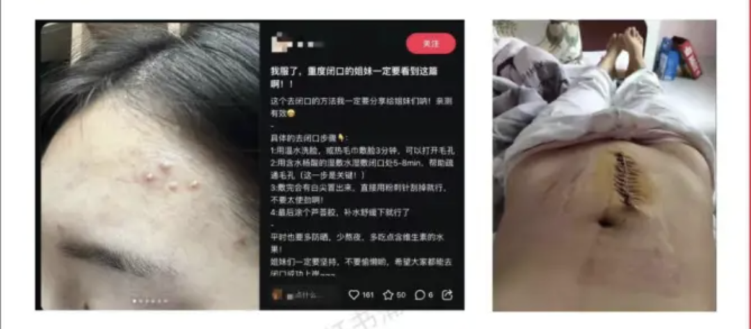 广告人干货库 小红书上线蒲公英低差营销规则-广告人干货库